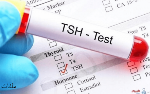 تحليل tsh وما هي أعراض قصور الغدة الدرقية